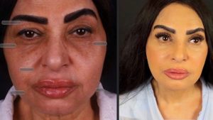سلوى خطاب تثير الجدل.. تداول صور لها بعد عمليات تجميل في الوجه والرقبة
