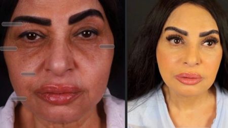سلوى خطاب تثير الجدل.. تداول صور لها بعد عمليات تجميل في الوجه والرقبة