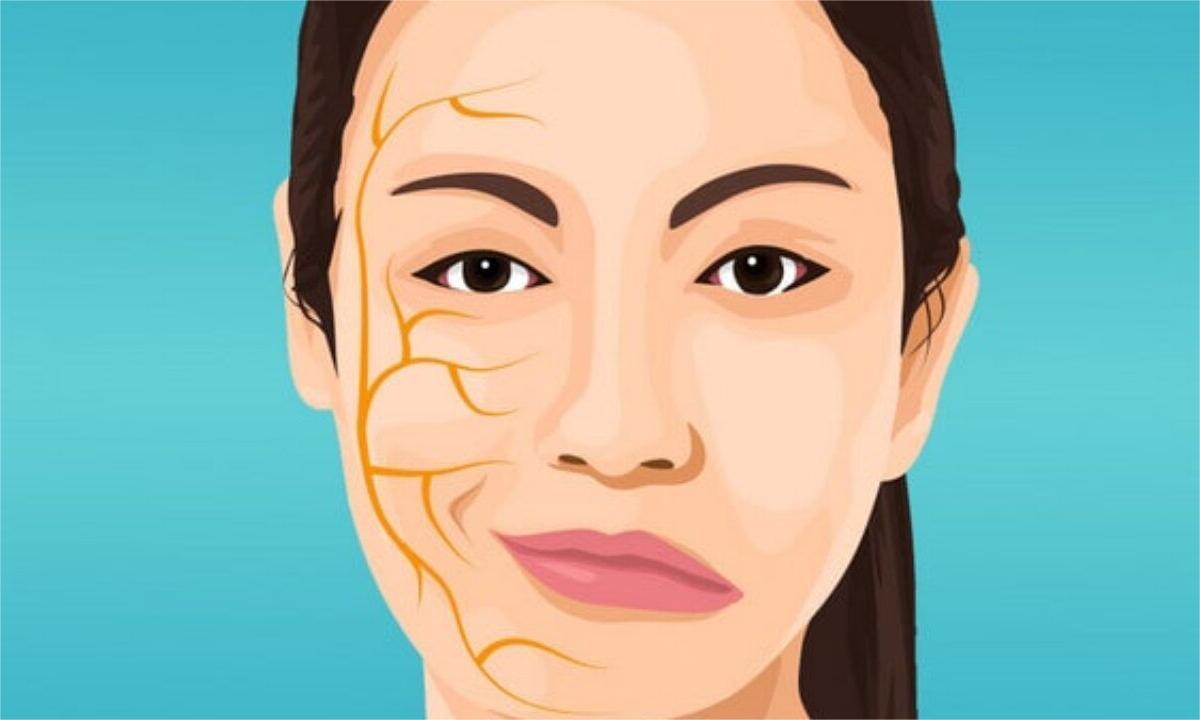 البوتكس لعلاج العصب السابع - عيادات ميدكا للجلدية والتجميل