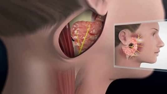 كل ما لا تعرفه عن الغدة النكافية.. الأعراض والمضاعفات وطرق الوقاية